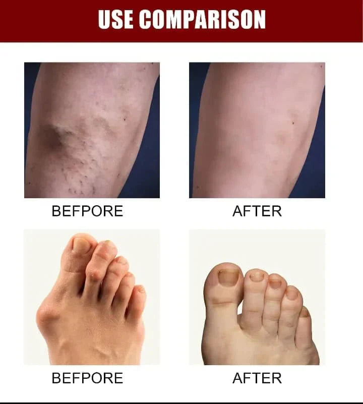 Bone Therapy Cream Pack of 2